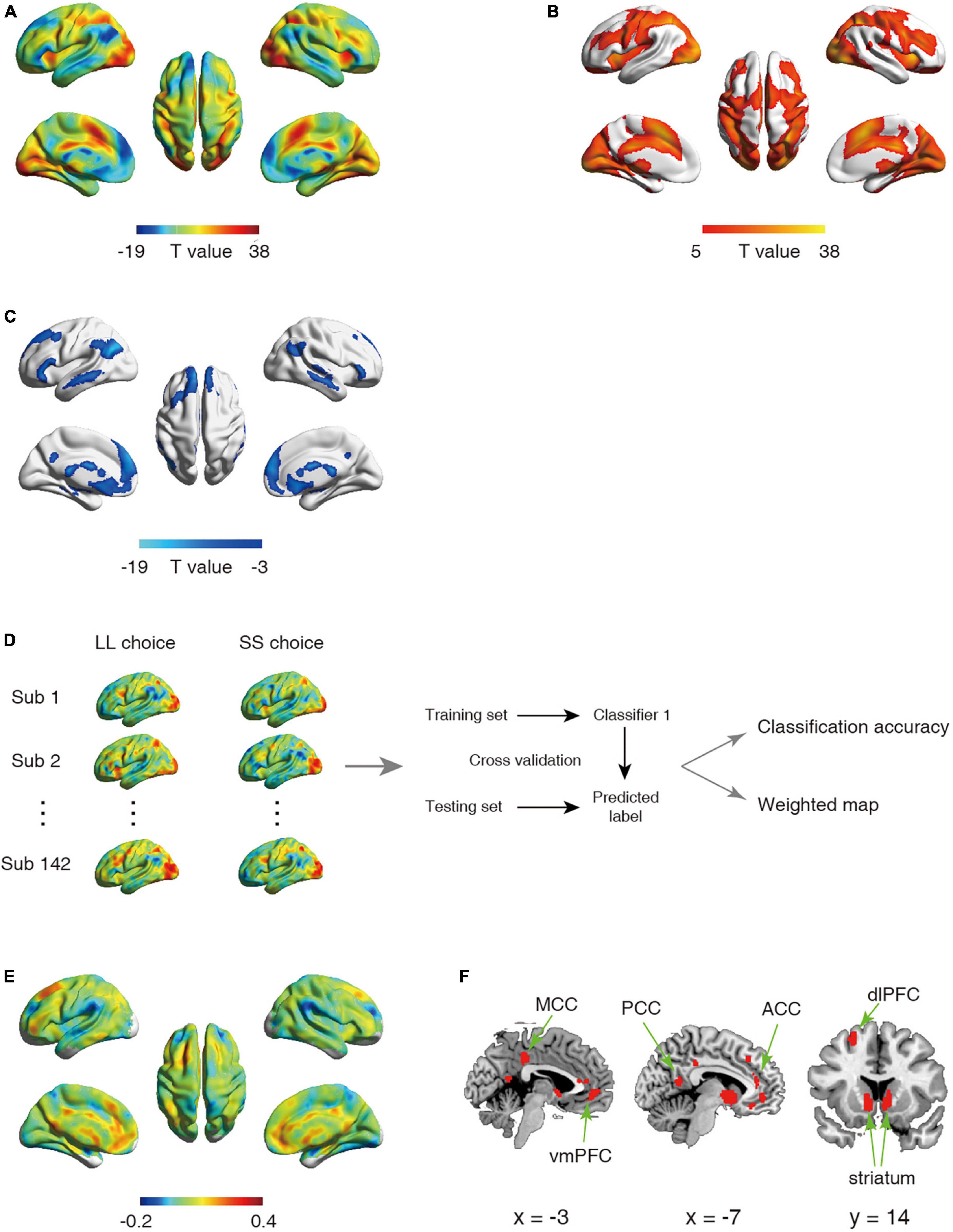 Multivariate analysis differentiates intertemporal choices in both value and cognitive control network